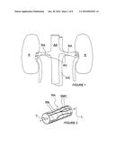 ULTRASOUND APPARATUSES FOR THERMALLY-INDUCED RENAL NEUROMODULATION AND     ASSOCIATED SYSTEMS AND METHODS diagram and image