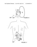 ULTRASOUND APPARATUSES FOR THERMALLY-INDUCED RENAL NEUROMODULATION AND     ASSOCIATED SYSTEMS AND METHODS diagram and image