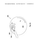 METHOD OF AND APPARATUS FOR CMP PAD CONDITIONING diagram and image