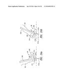 Gravitational Load Support System diagram and image