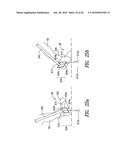 Gravitational Load Support System diagram and image