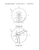 TORSION DEVICE diagram and image