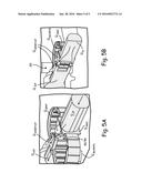 DUAL-STAGE GEAR PUMP WITH REDUCED PRESSURE RIPPLE diagram and image