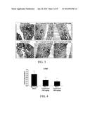 SUBSTITUTED AROMATIC COMPOUNDS FOR THE TREATMENT OF PULMONARY FIBROSIS,     LIVER FIBROSIS,SKIN FIBROSIS AND CARDIAC FIBROSIS diagram and image