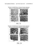 SUBSTITUTED AROMATIC COMPOUNDS FOR THE TREATMENT OF PULMONARY FIBROSIS,     LIVER FIBROSIS,SKIN FIBROSIS AND CARDIAC FIBROSIS diagram and image