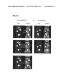 ANTI-MACROPHAGE MANNOSE RECEPTOR SINGLE VARIABLE DOMAINS FOR USE IN     CARDIOVASCULAR DISEASES diagram and image