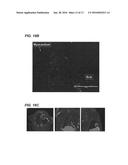 ANTI-MACROPHAGE MANNOSE RECEPTOR SINGLE VARIABLE DOMAINS FOR USE IN     CARDIOVASCULAR DISEASES diagram and image