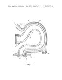 ANTI-OVERFLOW TOILET WITH DETACHABLE PRIMARY AND SECONDARY DRAIN TUBES diagram and image