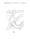 ANTI-OVERFLOW TOILET WITH DETACHABLE PRIMARY AND SECONDARY DRAIN TUBES diagram and image