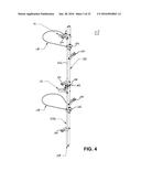 TREE-MOUNTED SUPPORTS diagram and image