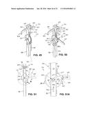 TREE-MOUNTED SUPPORTS diagram and image