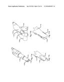 Angled Degradation Pick diagram and image