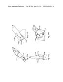 Angled Degradation Pick diagram and image