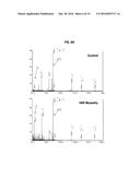 HYPOSIALYLATION DISORDERS diagram and image