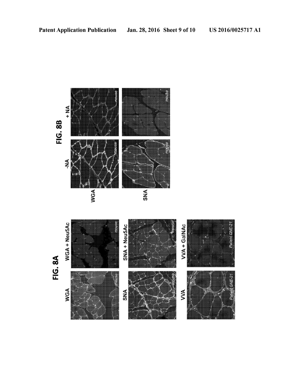 HYPOSIALYLATION DISORDERS - diagram, schematic, and image 10