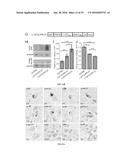 USE AND TREATMENT OF DI-AMINO ACID REPEAT-CONTAINING PROTEINS ASSOCIATED     WITH ALS diagram and image