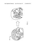 IMAGE REGISTRATION SYSTEM WITH NON-RIGID REGISTRATION AND METHOD OF     OPERATION THEREOF diagram and image