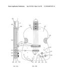 Acoustic-electric stringed instrument with improved body, electric pickup     placement, pickup switching and electronic circuit diagram and image