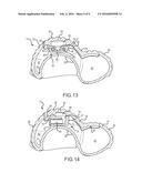 PET TOY WITH BALL HOLDING FEATURE diagram and image