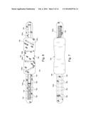 Stabilizing Belt diagram and image