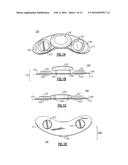 BODY WORN PHYSIOLOGICAL SENSOR DEVICE HAVING A DISPOSABLE ELECRODE MODULE diagram and image