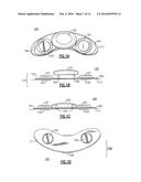 BODY WORN PHYSIOLOGICAL SENSOR DEVICE HAVING A DISPOSABLE ELECTRODE MODULE diagram and image