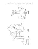 BODY WORN PHYSIOLOGICAL SENSOR DEVICE HAVING A DISPOSABLE ELECTRODE MODULE diagram and image