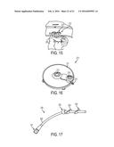 MEAL DETECTION DEVICES AND METHODS diagram and image