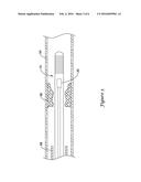 PRESSURE SENSING GUIDEWIRES diagram and image