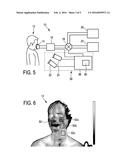 DEVICE AND METHOD FOR DETERMINING A PARTIAL CARBON DIOXIDE PRESSURE IN A     SUBJECT OF INTEREST diagram and image