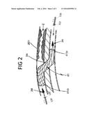 DEVICE AND METHOD FOR USING IVUS DATA TO CHARACTERIZE AND EVALUATE A     VASCULAR GRAFT CONDITION diagram and image