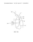 SYSTEMS AND METHODS FOR LOCATING AND/OR CHARACTERIZING INTRAGASTRIC     DEVICES diagram and image