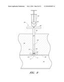 VASCULAR WOUND CLOSURE DEVICE AND METHOD diagram and image