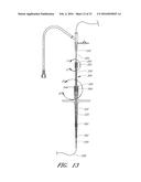 VASCULAR WOUND CLOSURE DEVICE AND METHOD diagram and image