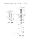 VASCULAR WOUND CLOSURE DEVICE AND METHOD diagram and image