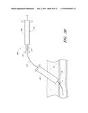 VASCULAR WOUND CLOSURE DEVICE AND METHOD diagram and image