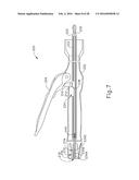 TISSUE STAPLER ANVIL FEATURE TO PREVENT PREMATURE JAW OPENING diagram and image