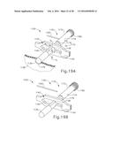 TISSUE STAPLER ANVIL FEATURE TO PREVENT PREMATURE JAW OPENING diagram and image