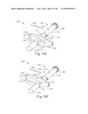 TISSUE STAPLER ANVIL FEATURE TO PREVENT PREMATURE JAW OPENING diagram and image