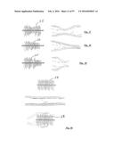 EMBOLISATION SYSTEMS diagram and image