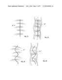 EMBOLISATION SYSTEMS diagram and image