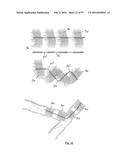 EMBOLISATION SYSTEMS diagram and image