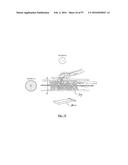 EMBOLISATION SYSTEMS diagram and image