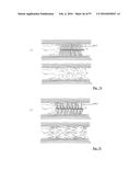 EMBOLISATION SYSTEMS diagram and image