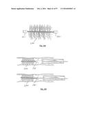 EMBOLISATION SYSTEMS diagram and image