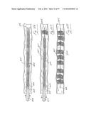 EMBOLISATION SYSTEMS diagram and image