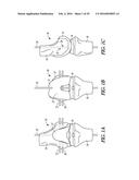 INSTRUMENTS AND METHODS IN PERFORMING KINEMATICALLY-ALIGNED TOTAL KNEE     ARTHROPLASTY diagram and image