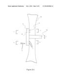 SURGICAL APPARATUS diagram and image