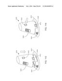 MEDICAL DEVICE INSERTERS AND PROCESSES OF INSERTING AND USING MEDICAL     DEVICES diagram and image