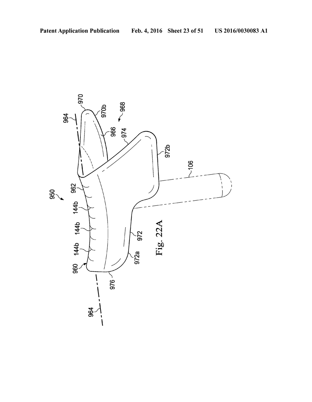 Externally Applied Intrapartum Support Device - diagram, schematic, and image 24